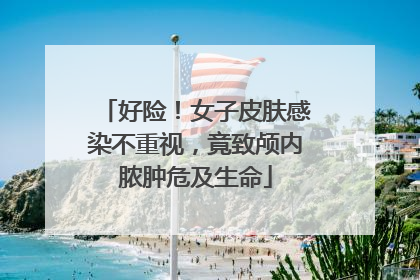 好险！女子皮肤感染不重视，竟致颅内脓肿危及生命